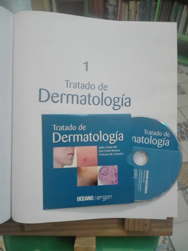642590-MLA85620012990_062025 Tratado De Dermatología 2 Tomos + 1 Cd - Conejo Mir - Océano
