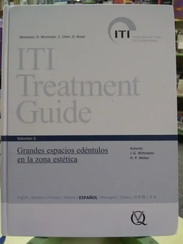 667691-MLA46079475526_052021 Iti Treatment Guide Vol. 6 Grandes Espacios Edéntulos ...
