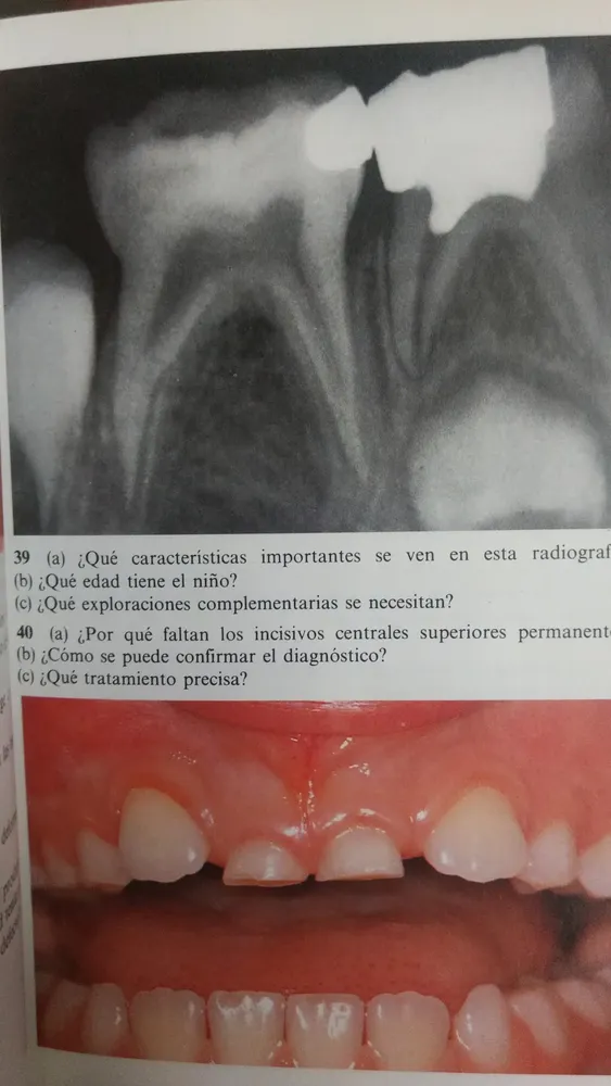 Odontología Pediátrica - Rock, Grundy, Shaw -