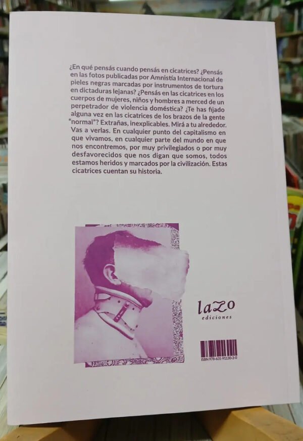 Más Allá De La Amnistía: Autolesión Y Revuelta - Anónimo