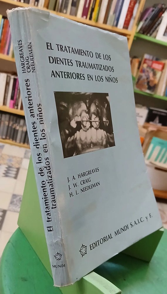 Tratamiento De Dientes Traumatizados En Niños - Hargreaves