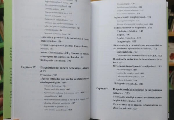 Prevención Y Diagnóstico Del Cáncer Bucal - J. Santana Garay