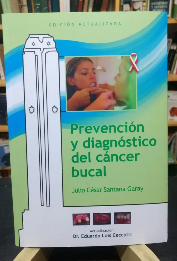 Prevención Y Diagnóstico Del Cáncer Bucal - J. Santana Garay