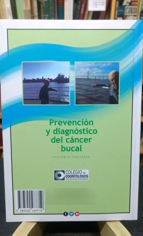 Prevención Y Diagnóstico Del Cáncer Bucal - J. Santana Garay