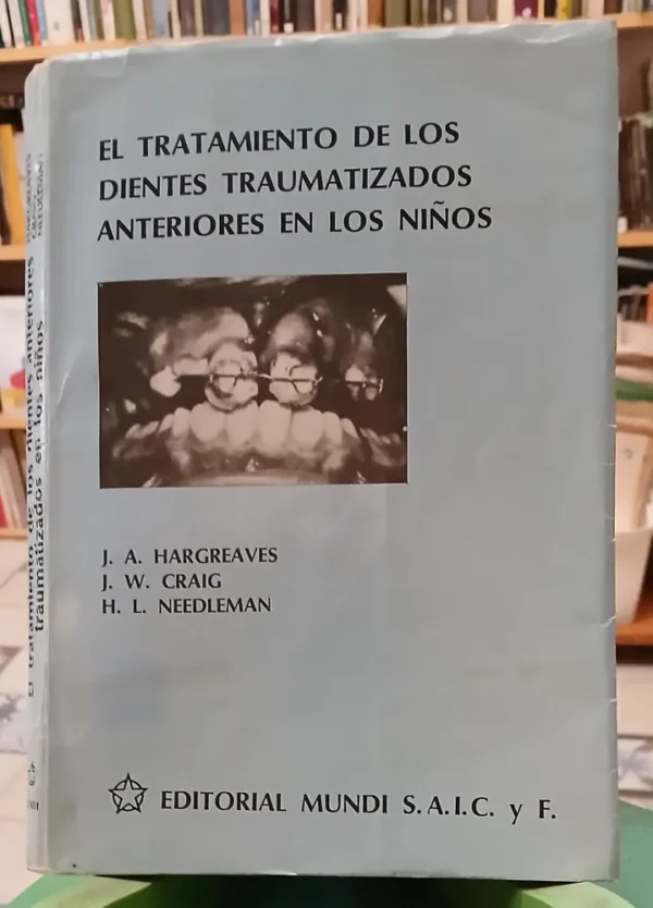 Tratamiento De Dientes Traumatizados En Niños - Hargreaves