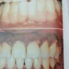 666694-MLA90563438925_082025 Periodontología Clínica De Glickman - F. A. Carranza