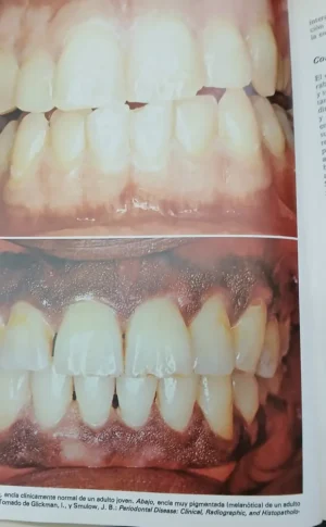 666694-MLA90563438925_082025 Periodontología Clínica De Glickman - F. A. Carranza