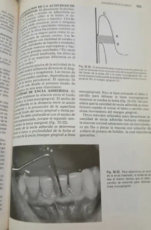 765582-MLA90180761218_082025 Periodontología Clínica De Glickman - F. A. Carranza