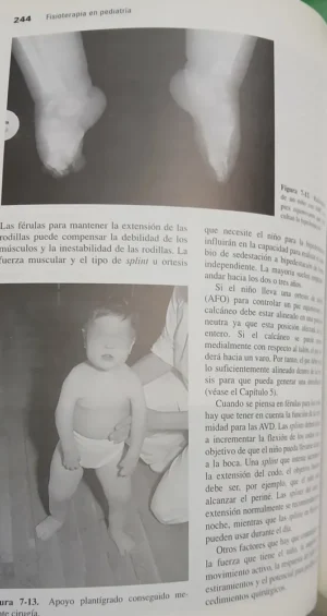 882033-MLA107259268638_032026 Fisioterapia En Pediatría - L Macias Merlo - J Fagoaga Mata
