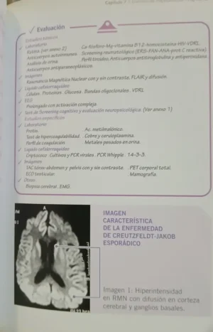 923496-MLA95634958710_102025 Demencias Para El Consultorio General - J Bustin - P Richly